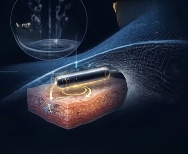 GI MetabolicNode™ biometric device